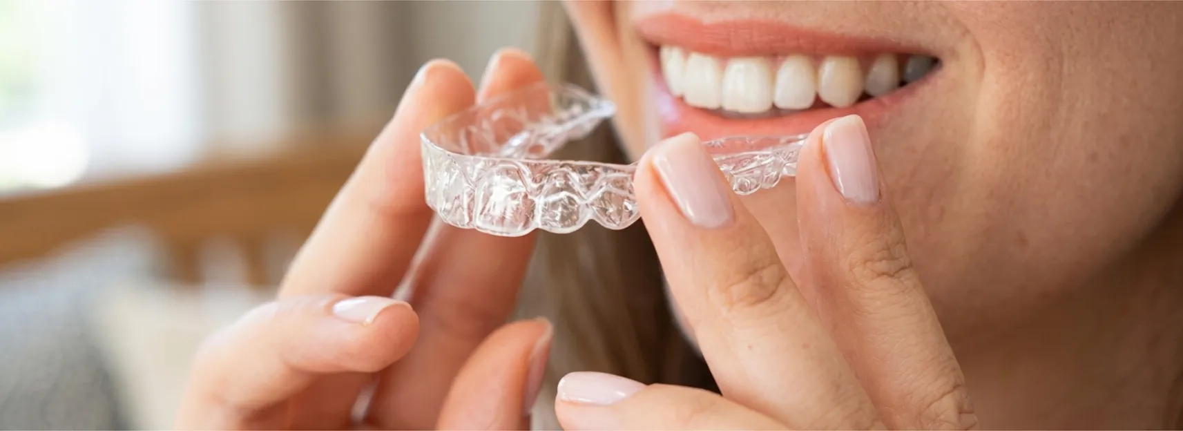 Ortodonzia trasparente Dottor Bartolomeo Ariano | Odontoiatra Dentista Torino | Allineatori trasparenti