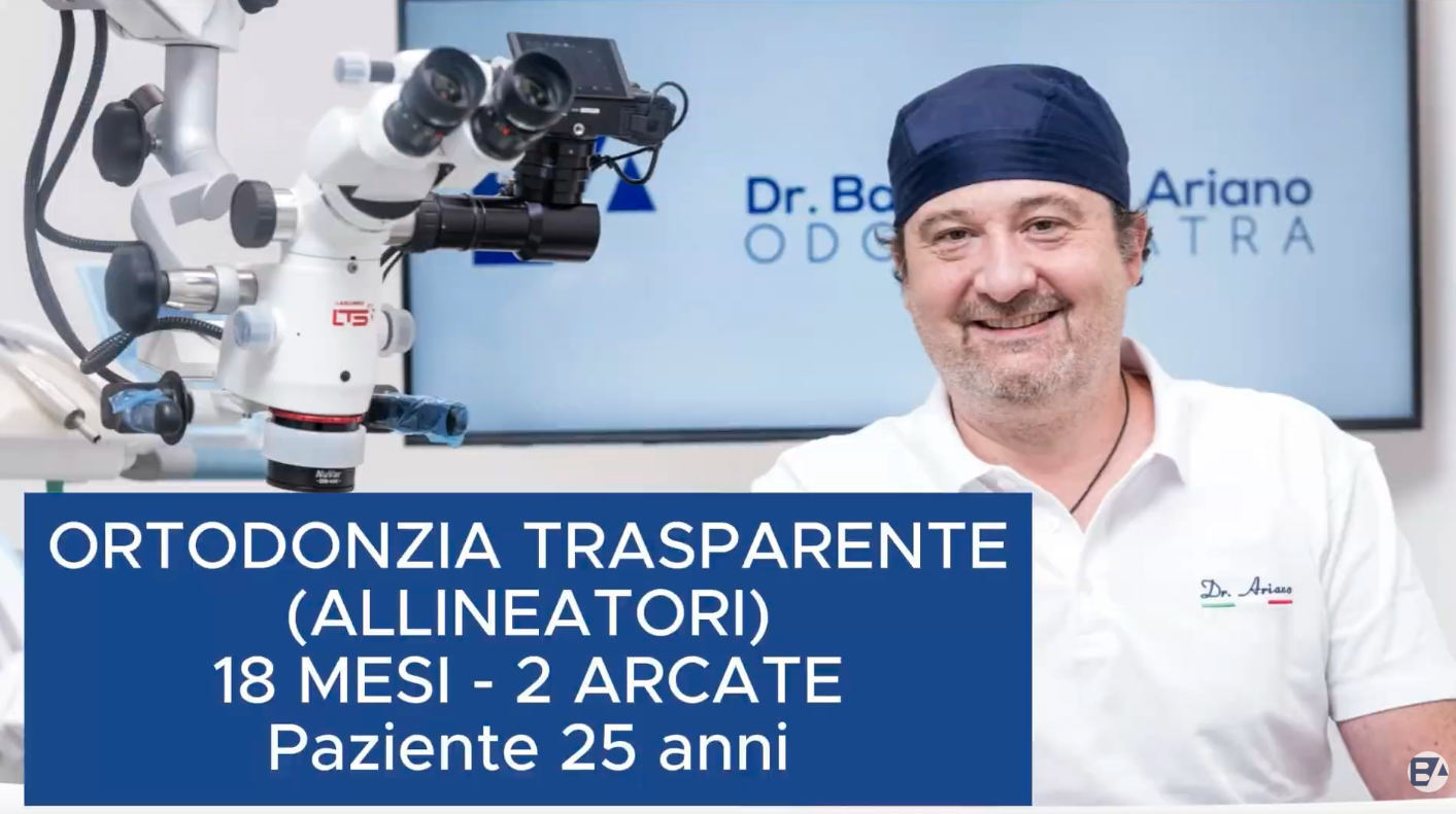 25 anni - Allineatori - 18 mesi